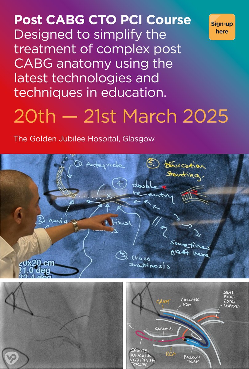 VP Med Group (@vp_med) on Twitter photo We're excited to announce our first fully interactive CTO CABG Course at <a href="/JubileeHospital/">NHS Golden Jubilee</a>
🔹 Case-based learning like never before
🔹 Live interactions with delegates
🔹 Real-time annotations & simplified techniques
Sign up now 👉 bit.ly/3EjUAg1
#Cardiologists #NHS We're excited to announce our first fully interactive CTO CABG Course at <a href="/JubileeHospital/">NHS Golden Jubilee</a>
🔹 Case-based learning like never before
🔹 Live interactions with delegates
🔹 Real-time annotations & simplified techniques
Sign up now 👉 bit.ly/3EjUAg1
#Cardiologists #NHS