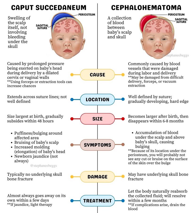 NurseHann100's tweet image. CAPUT SUCCEDANEUM VS CEPHALOHEMATOMA