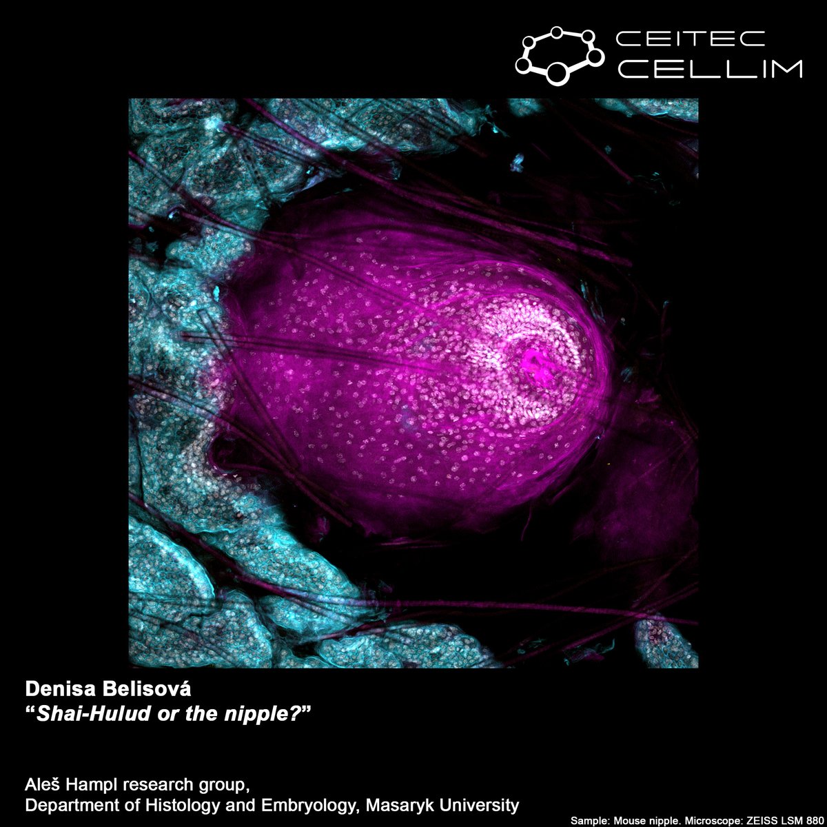 Zuzana Sumbalova Koledova (@koledovazuzana) on Twitter photo 📢 Vote for Science! 🧬🔬 My student & friend <a href="/DBelisova/">Denisa Belisová</a> has an incredible image in the <a href="/Ceitec_CellimCF/">Cellular Imaging Core Facility - CEITEC</a> Imaging Contest 2024! 🌟 Show your support & help her win by voting here: cellim.ceitec.cz/contest-2024/ 🗳️ <a href="/dunemovie/">DUNE</a> <a href="/Science_MEDMUNI/">Science @ MED MUNI</a> Voting ends 6 Feb 23:59! 📢 Vote for Science! 🧬🔬 My student & friend <a href="/DBelisova/">Denisa Belisová</a> has an incredible image in the <a href="/Ceitec_CellimCF/">Cellular Imaging Core Facility - CEITEC</a> Imaging Contest 2024! 🌟 Show your support & help her win by voting here: cellim.ceitec.cz/contest-2024/ 🗳️ <a href="/dunemovie/">DUNE</a> <a href="/Science_MEDMUNI/">Science @ MED MUNI</a> Voting ends 6 Feb 23:59!