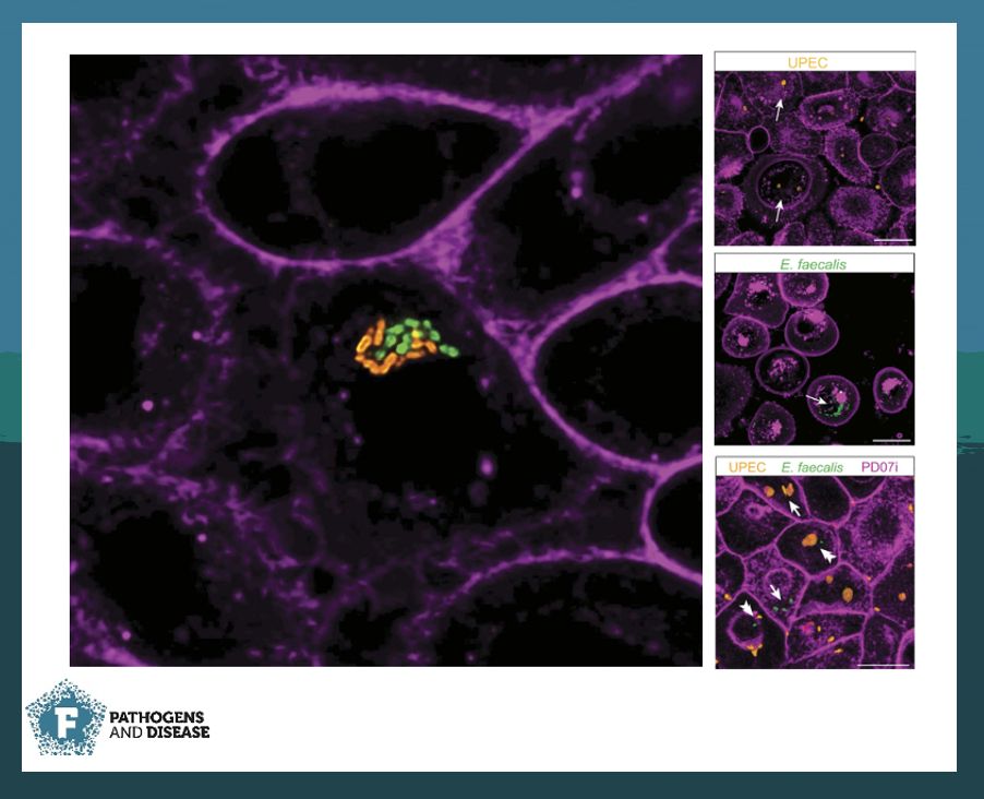 The importance of #HostPathogen models for the study of #UTI infections🔬. Check out our Latest Editor's Choice: Abell-King et al. explore #multispecies #bacterial behaviour using clinical strains and human #bladder models 🧫. 

buff.ly/4aGNxKD

#PathogDis