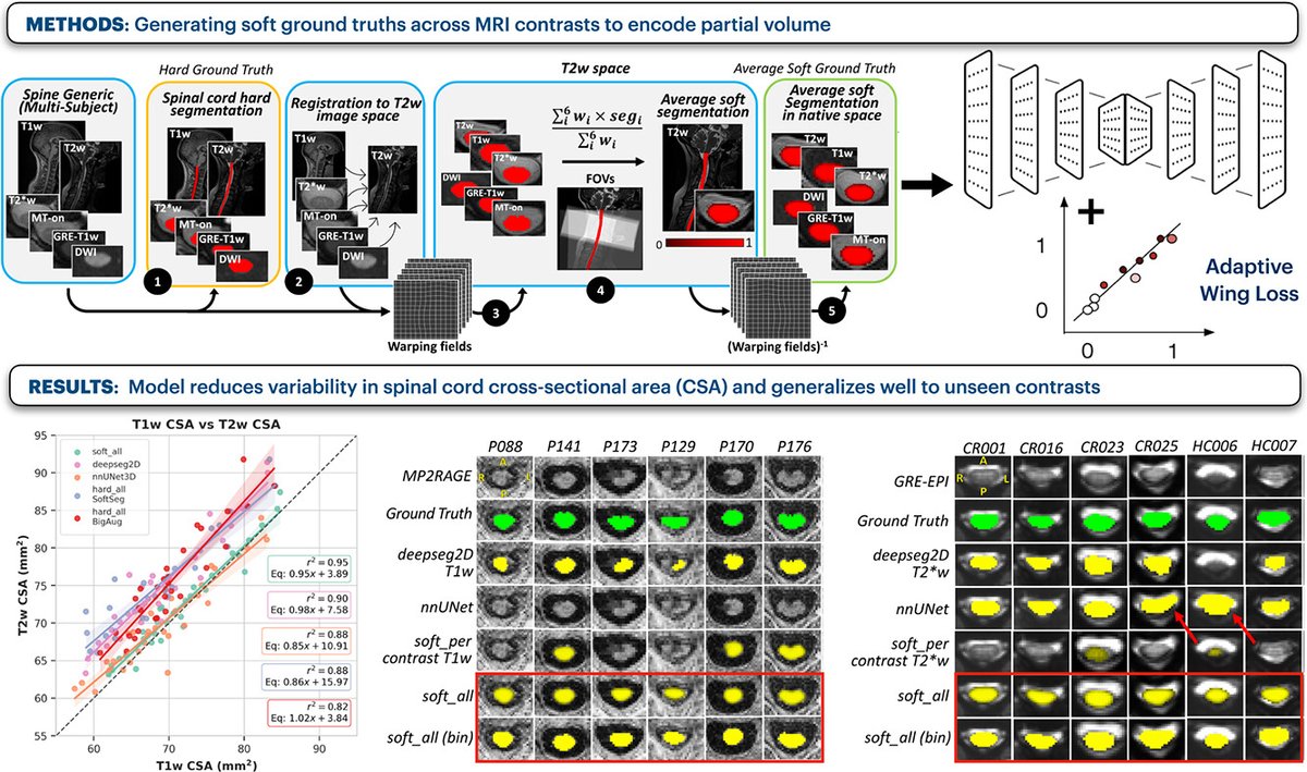 Julien Cohen-Adad (@jcohenadad) on Twitter photo Having trouble segmenting the spinal cord on T1w? T2w? MP2RAGE? EPI? PSIR? STIR? FLAIR? Check out this work by <a href="/SandBedard/">Sandrine Bédard</a> <a href="/naga_karthik7/">Naga Karthik</a> and colleagues on the new contrast-agnostic segmentation model (available on <a href="/SpinalToolbox/">Spinal Cord Toolbox (SCT)</a>) 🚀 Having trouble segmenting the spinal cord on T1w? T2w? MP2RAGE? EPI? PSIR? STIR? FLAIR? Check out this work by <a href="/SandBedard/">Sandrine Bédard</a> <a href="/naga_karthik7/">Naga Karthik</a> and colleagues on the new contrast-agnostic segmentation model (available on <a href="/SpinalToolbox/">Spinal Cord Toolbox (SCT)</a>) 🚀