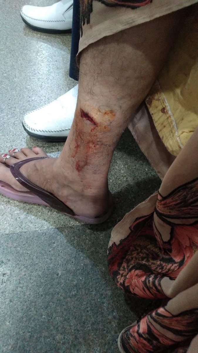 kssprince's tweet photo. Every day, dogs are biting small children &amp; others. Currently , there are over 100 dogs in JP Kosmos, Noida. A woman running an NGO in the society &amp; brings in new street dogs everyday as she earns money for each dog. #noida_authority #news #AajTakSocial #zeenews #ABPNews https://t.co/qKDMk2WhRl