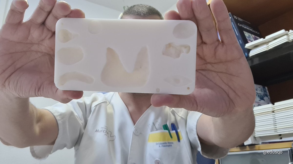 edusqo's tweet photo. La próxima semana reanudamos prácticas clínicas, desarrollando habilidades técnicas, empleando simulación. Ésto 📷, ha conseguido la estandarización y mejora de las prácticas en la institución y la formación y satisfacción de los alumnos.
#MedEd #3D #Alginato #AnatomíaPatológica https://t.co/fZh5vz2HGv