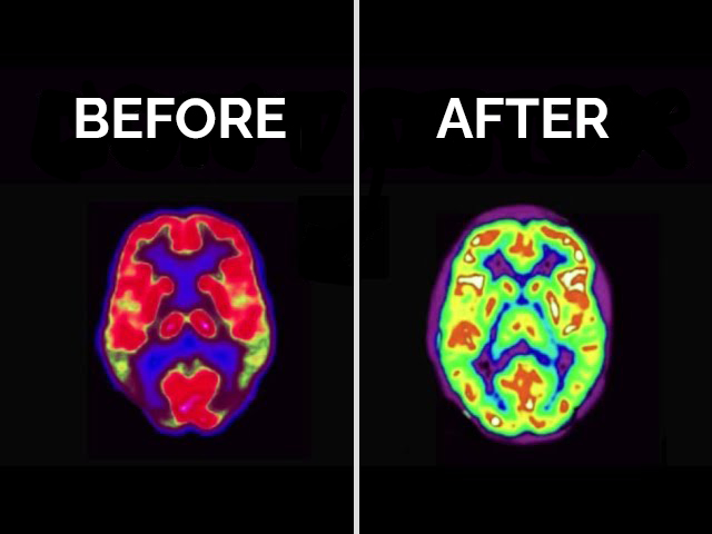DOPAMINE:

The molecule that controls your life.

It’s the reason you watch po*n, you’re addicted to your phone, and you have zero motivation to work.

Here’s what dopamine REALLY is, how it hijacks your brain, and how to stop it from killing you (backed by science):