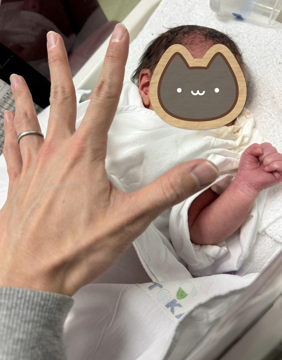 micro_wall's tweet image. ようこそ世界へ

2月3日
予定日丁度に双子ちゃんがお姉ちゃんになりました。
三姉妹になりました。

母子共に健康です。

合計5.5kgの双子を帝王切開で産み、TOLACを選び3kgの赤ちゃんを自然分娩で無事産んだ妻。
なんだ最強か？

ちっちゃい可愛い

ありがとう世界
おめでとう世界