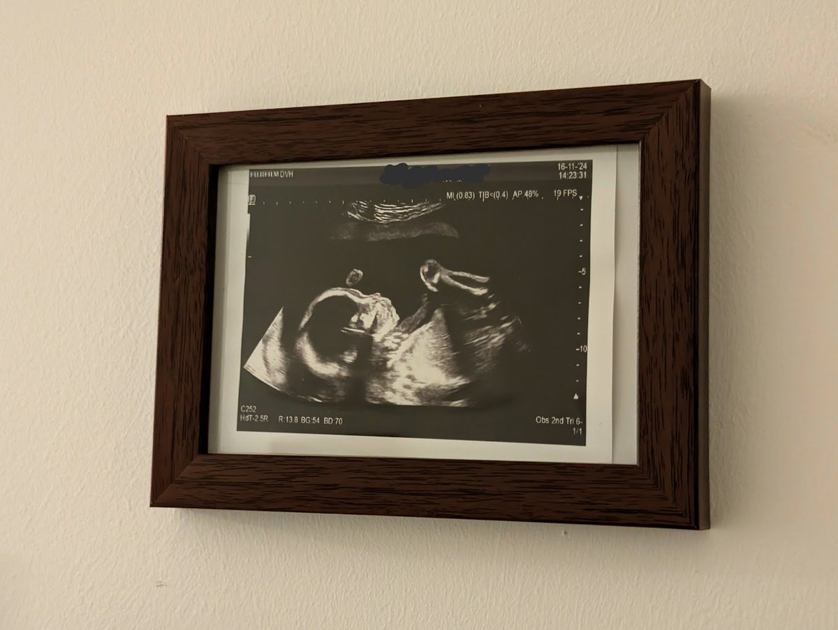 Been a bit quiet lately... but for good reason!

I’ve just finished revising my website and updating my offerings, check it out at callumfackrell.com.

On top of that, I’ve got some big news: I’m expecting my first child at the end of March! 🎉 As you can imagine, I’m trying