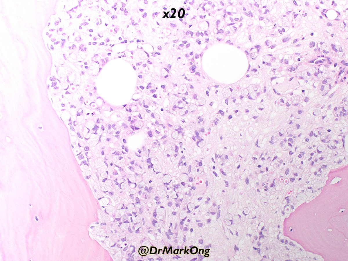 Mark Ong tweet media