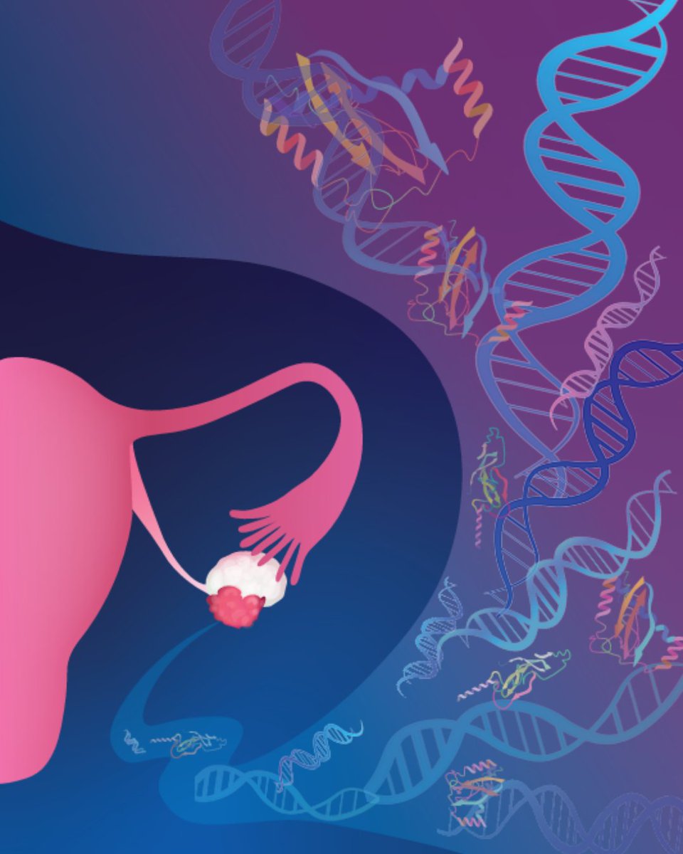 From the January issue: Early Detection of #OvarianCancer Using Cell-Free DNA Fragmentomes and Protein Biomarkers brnw.ch/21wQrnm

By Jamie Medina, <a href="/av_annapragada/">Akshaya Annapragada</a>, Jillian Phallen,  Christine Lok, <a href="/velculescu/">Victor Velculescu</a> and colleagues <a href="/hopkinskimmel/">Johns Hopkins Kimmel Cancer Center</a>