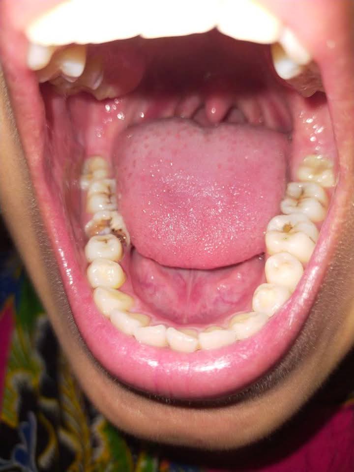 DentistRoom's tweet photo. https://t.co/tvP5H0nybI