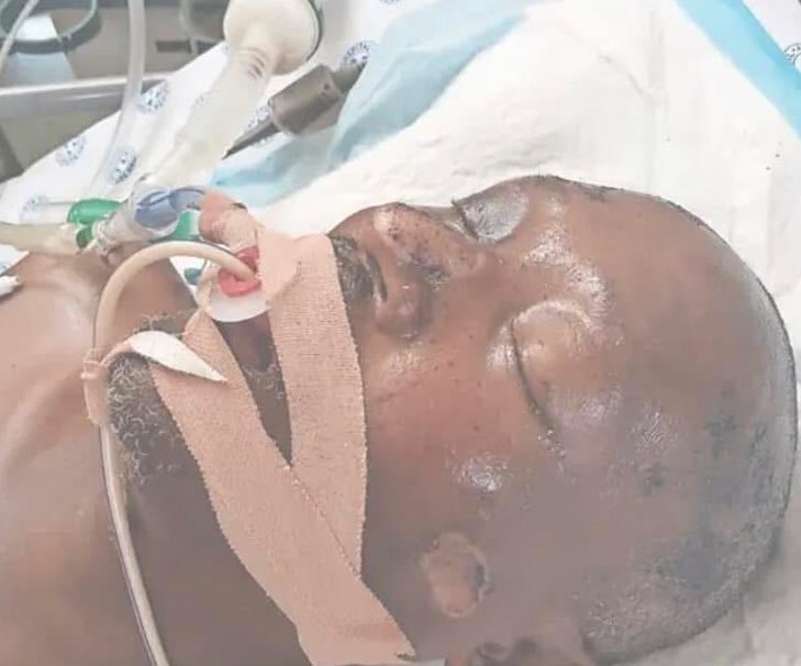 mbalis_bakery's tweet photo. “Witbank Hospital is seeking public assistance in locating the family members of a patient currently receiving treatment in ICU.

France Mabena, a pedestrian involved in a vehicle accident on January 22, needs his family’s support during this critical time.

 Unfortunately, he has been unable to contact his relatives, and his condition remains a concern.
 
Witbank Hospital’s social worker is urgently seeking anyone with information about Mabena’s family to come forward. If you are a relative or know someone who is, please contact the hospital immediately.

Contact details
Witbank Hospital : 013 653 2000
ICU ward 20: 013 653 2393

Your response could make a difference in Mabena’s recovery.”