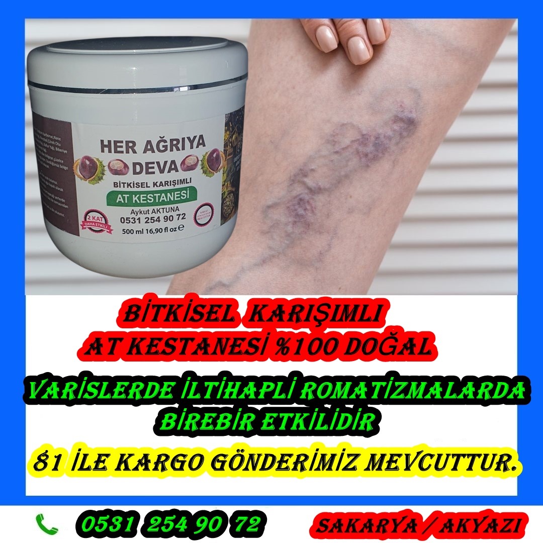 BİTKİSEL KARISIMLI AT KESTANESİ 

WHATSAP SİPARİŞ HATTI 👇👇

wa.me/905312549072 

#bitkiselkarışımlıkrem #masajsalonu #belfıtığı