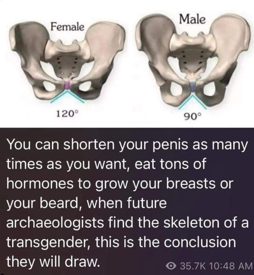 vanvlietma56864's tweet image. I love:
#TransSiberianExpress
#Transportationengineering 
#Transit
#Transducer
#Translation
#Transfer
#Transaction
#Transplantation
#Transportagent
#Transformator
#Transformers 
#Transmission
#Transistor

But NO #transgendermadness #transgenderidiotery
That&apos;s psychiatry! #DSM5