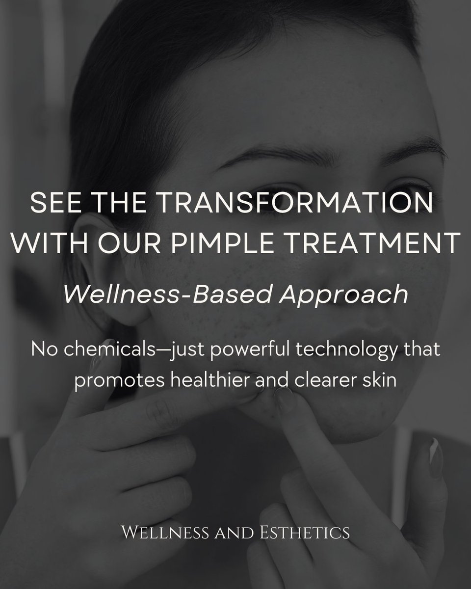 drbatcheller's tweet photo. Clear, Smooth Skin Starts Here ✨

Struggling with stubborn breakouts? Our pimple treatment is designed to calm irritation, reduce redness, and prevent future flare-ups—giving you the clear skin you deserve!

#PimpleTreatment #ClearSkin #BreakoutSolutions #GlowingComplexion https://t.co/seM9qiUkCE