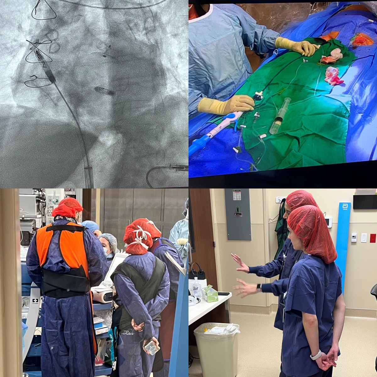 EpProgram's tweet image. Last week we had our first day of clinical observations. A couple of our students were fortunate enough to visit our Texas Medical Center site and observe a lead extraction and reimplant of a dual chamber Aveir! They learned from doctors, Abbott reps and staff. Brings the…