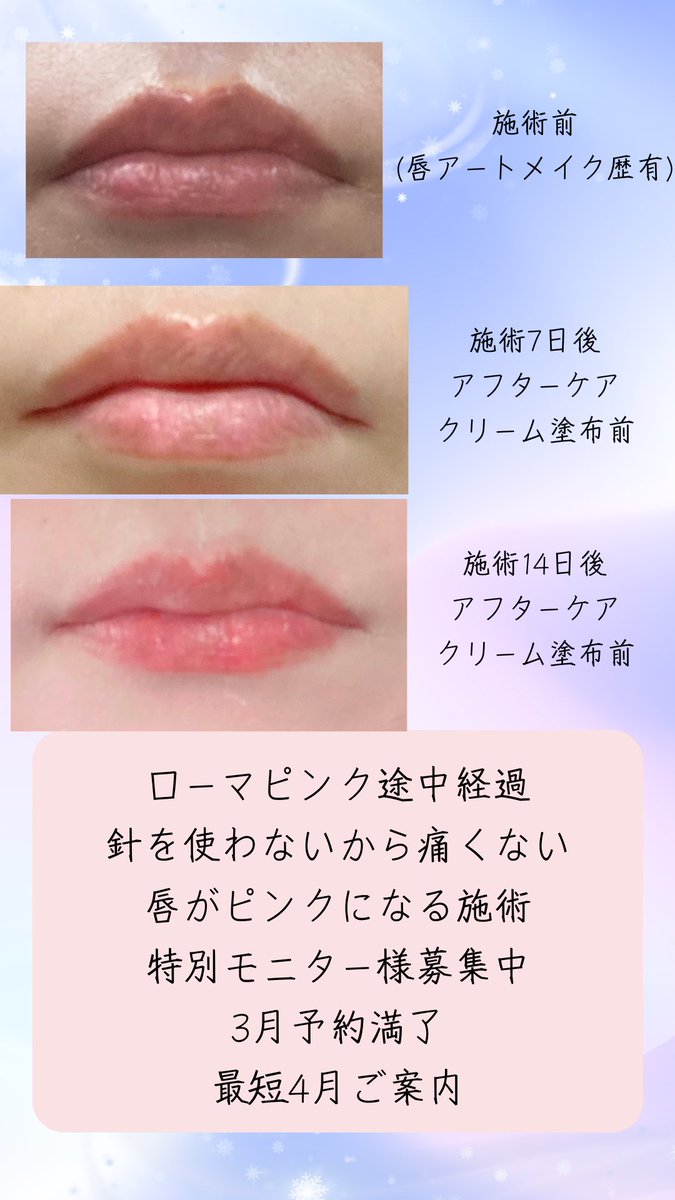 り*ご様 ローマピンク アフタークリーム 唇用 | APPS-BICENTENARIO-PRD