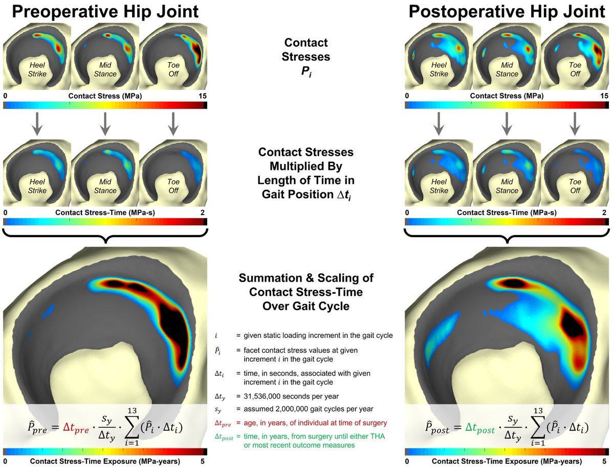 Rabeeh Majidi, Ph.D. (@rabeeh_m) on Twitter photo New <a href="/JOrthopRes/">Journal of Orthopaedic Research®</a> study finds abnormal hip mechanics predict joint failure 10+ years after periacetabular osteotomy, stressing the need to optimize contact stress for better outcomes. #HipDysplasia #PAO #JointHealth #SportsMedicine #ORSSMC
<a href="/ORSsociety/">Orthopaedic Research Society</a>
doi.org/10.1002/jor.25… New <a href="/JOrthopRes/">Journal of Orthopaedic Research®</a> study finds abnormal hip mechanics predict joint failure 10+ years after periacetabular osteotomy, stressing the need to optimize contact stress for better outcomes. #HipDysplasia #PAO #JointHealth #SportsMedicine #ORSSMC
<a href="/ORSsociety/">Orthopaedic Research Society</a>
doi.org/10.1002/jor.25…