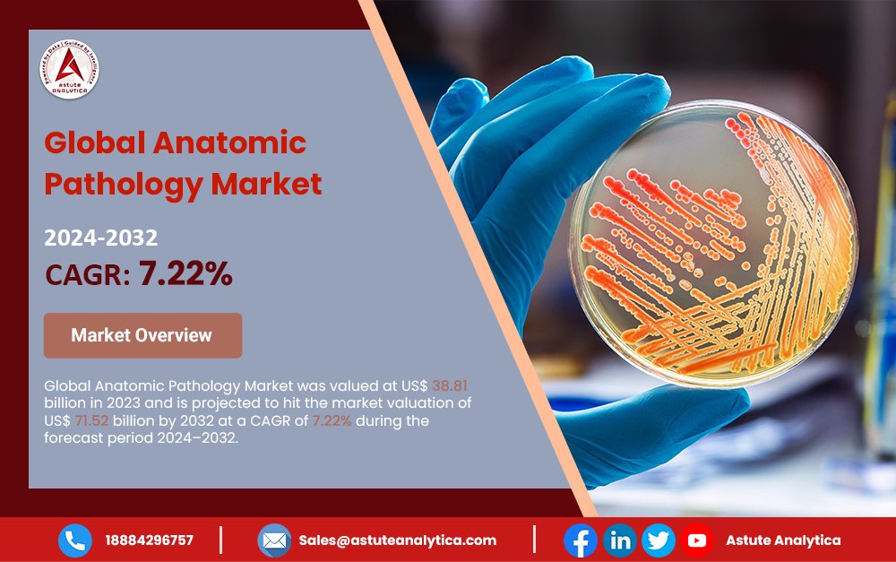AstuteAnalytic1's tweet image. 𝐆𝐥𝐨𝐛𝐚𝐥 𝐀𝐧𝐚𝐭𝐨𝐦𝐢𝐜 𝐏𝐚𝐭𝐡𝐨𝐥𝐨𝐠𝐲 𝐌𝐚𝐫𝐤𝐞𝐭 𝐨𝐧 𝐚 𝐆𝐫𝐨𝐰𝐭𝐡 𝐓𝐫𝐚𝐣𝐞𝐜𝐭𝐨𝐫𝐲!

The Global #Anatomic #pathology  #Market was valued at US$ 38.81 billion in 2023 and is projected to reach US$ 71.52 billion by 2032, growing at a CAGR of 7.22% (2024–2032).