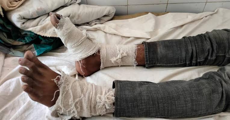 আমতলীতে ভাগ্নের পায়ের রগ কাটলেন মামা