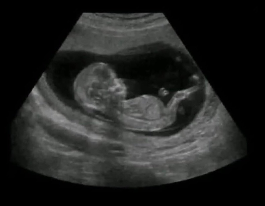 sene 2001 yine tus çalışmak yerine yatıyorum