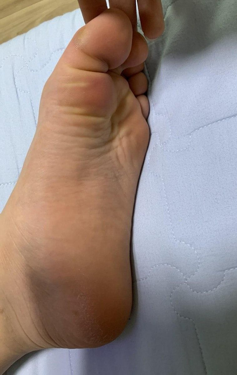 맨발로 걸어다니게 하고
심하게 때려서 멍들게 한 다음
간지럼 태우고 싶다.