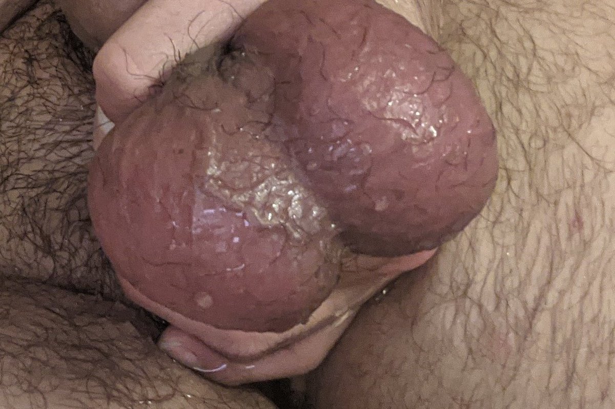 Photo drop
🤜🏽🥚🥚🤛🏽

#balls #BALLS #Balls #testicles #cbt #Cbt #latinoballs #ballbusting #Ballbusting #swollenballs #gayballs #gaynsfw #nsfw #NSFW #nuts #nutkick #hugeballs