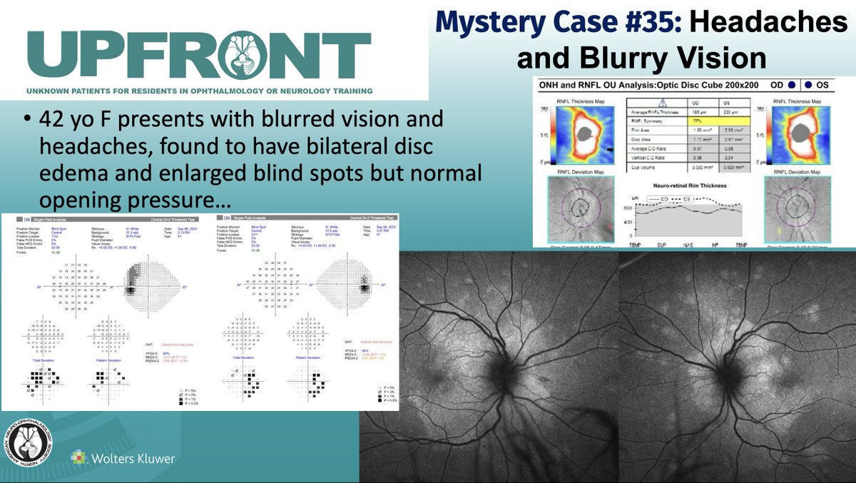 UPFRONT Mystery Case #35: Headaches and Blurry Vision: Journal of Neuro-Ophthalmology
Article: bit.ly/JNO_UPFRONT35 or on bit.ly/JNO_Home
 #brain #eye #vision #research #Neurology #NeuroOphth #Ophthalmology #Medicine #OpticDiscEdema #Mimicker <a href="/HopkinsMedicine/">Johns Hopkins Medicine</a>