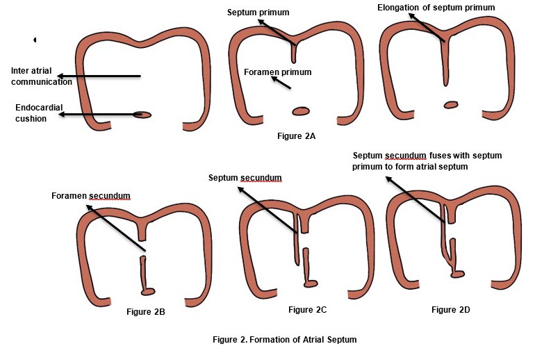 TrackYourHeart's tweet photo. HOW THE HEART BUILDS ITS WALLS: The Fascinating Story of Atrial Septation🫀

The human heart starts as a single primitive atrium. But how does it divide into two separate chambers?
Let’s break down the formation of the atrial septum in a simple way. 

A thread