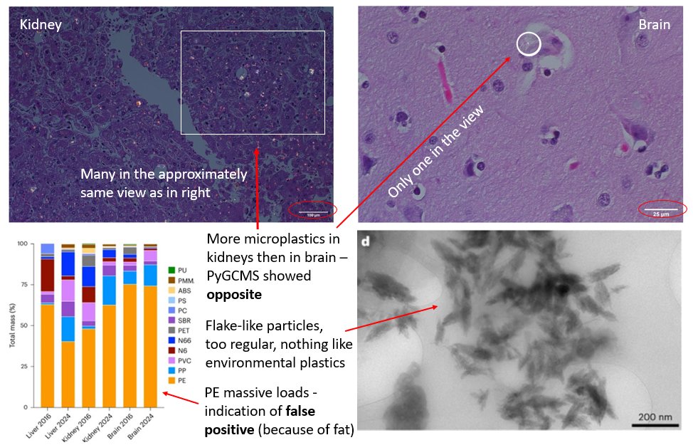 Scientists don't have time to ask themselves hard questions!
The brain #microplastic paper is a joke:
Fat makes false positive PE - see missing high m/z ions in PyGCMS. 
The brain has ~60% fat, and liver has ~5%, so that is why ~10x more "plastics" there.
doi.org/10.1038/s41591…