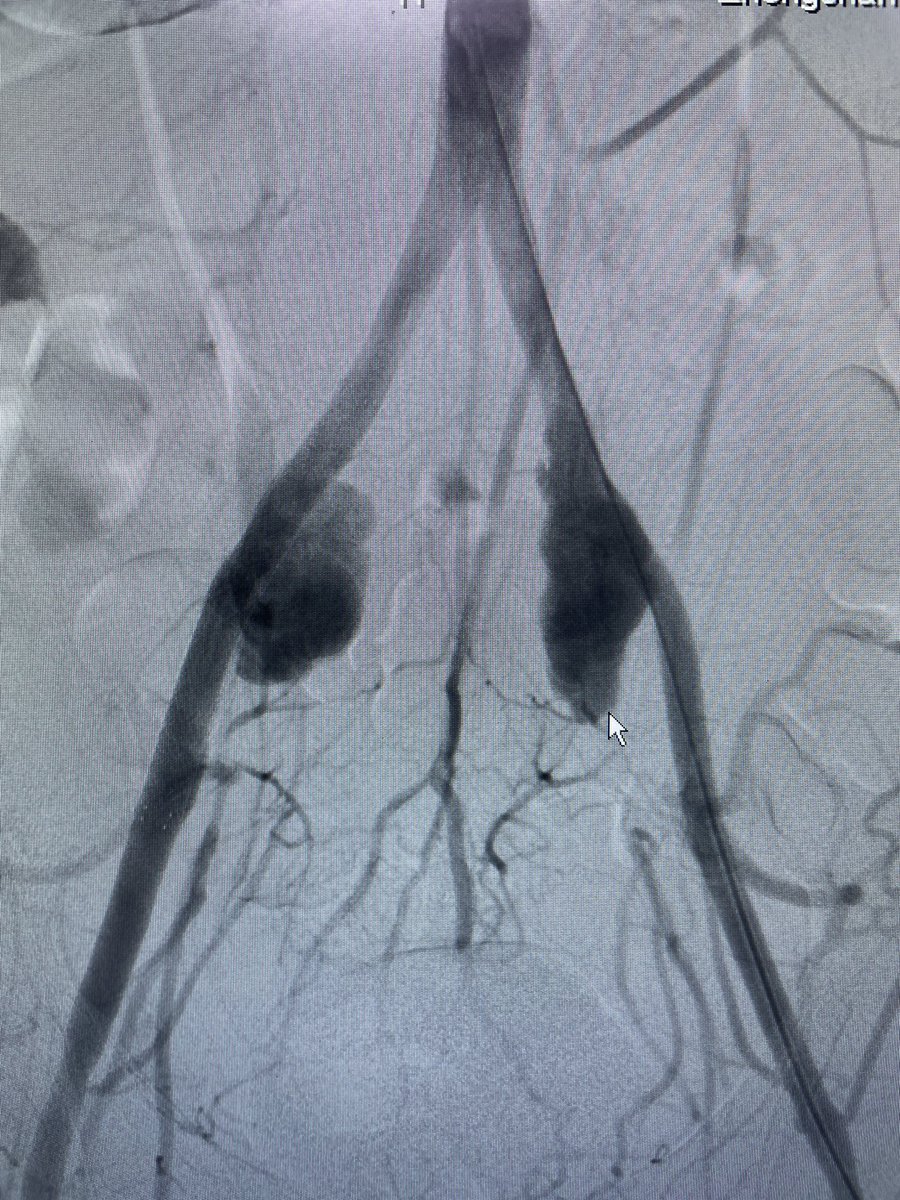 Jianing Yue_Vas Surg in Shanghai tweet media