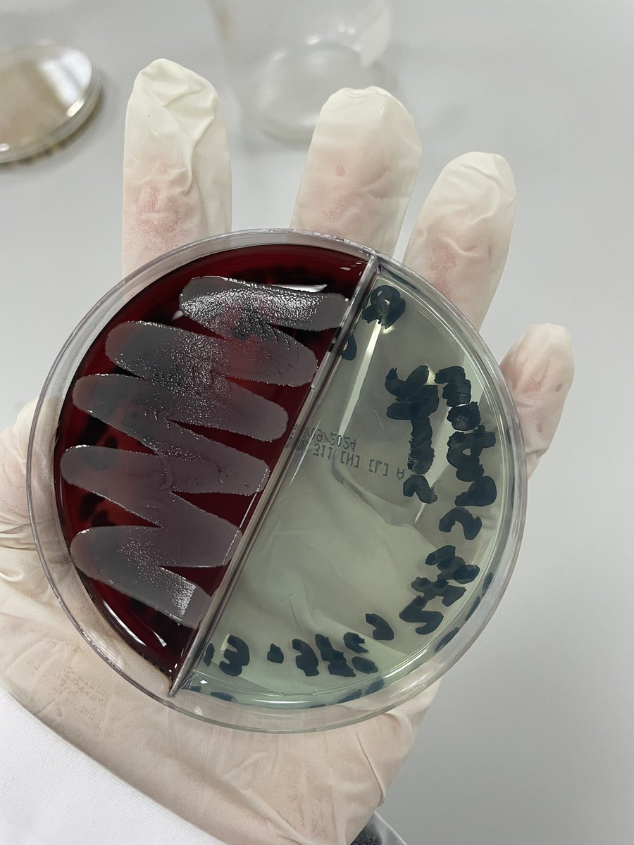 jineem13's tweet photo. Staphylococcus aureus on blood agar &amp; under microscope ✨🧫🔬 https://t.co/Uqtds88Qu2