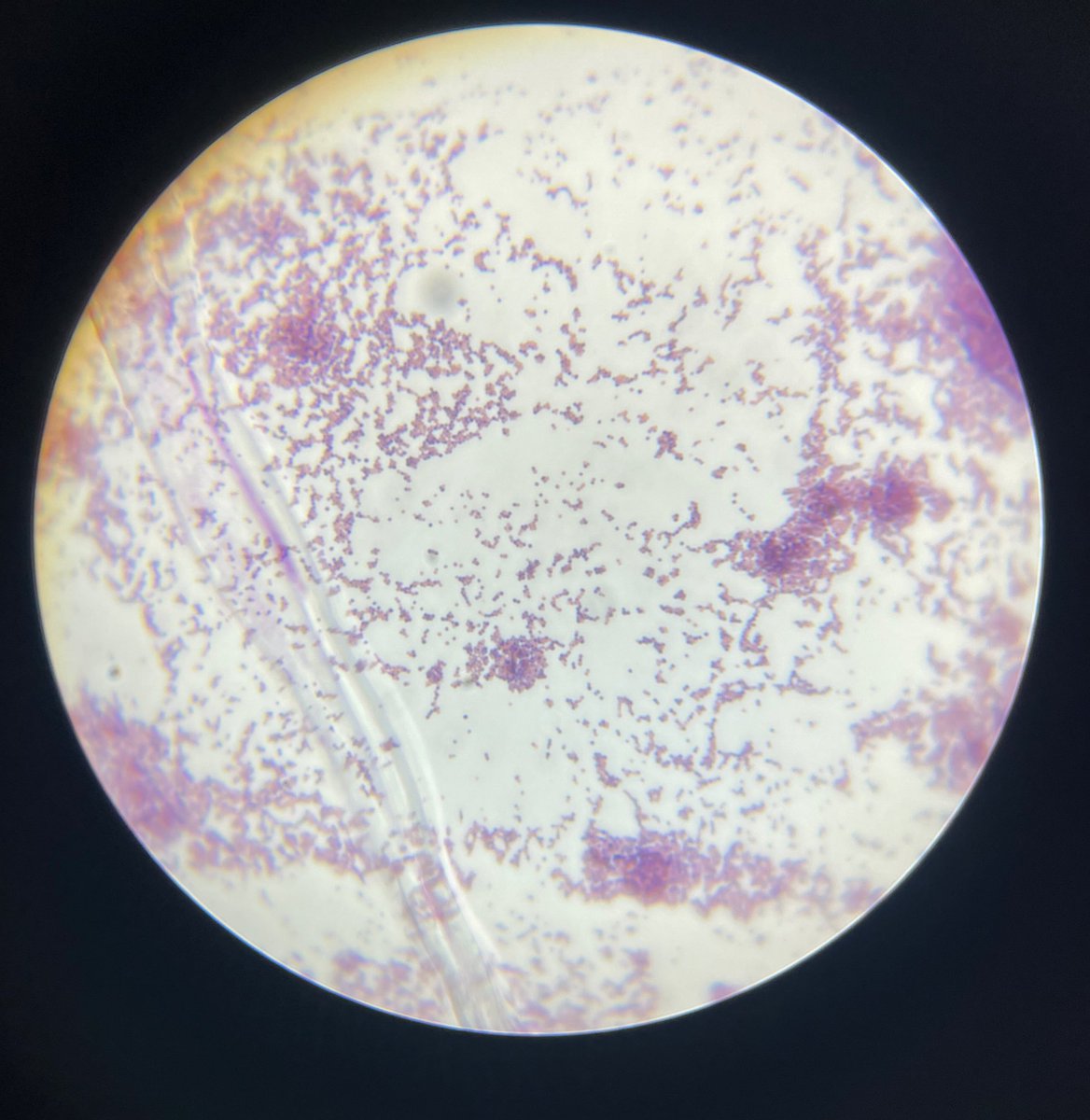 jineem13's tweet photo. Staphylococcus aureus on blood agar &amp; under microscope ✨🧫🔬 https://t.co/Uqtds88Qu2