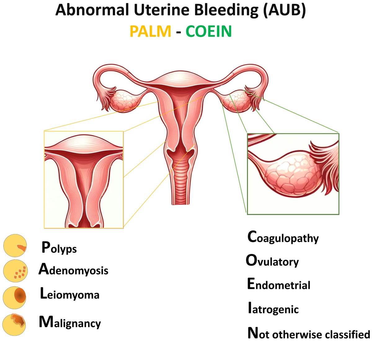 Abnormal #UterineBleeding: Saudi Guideline
jcgo.elmerpub.com/index.php/jcgo…
