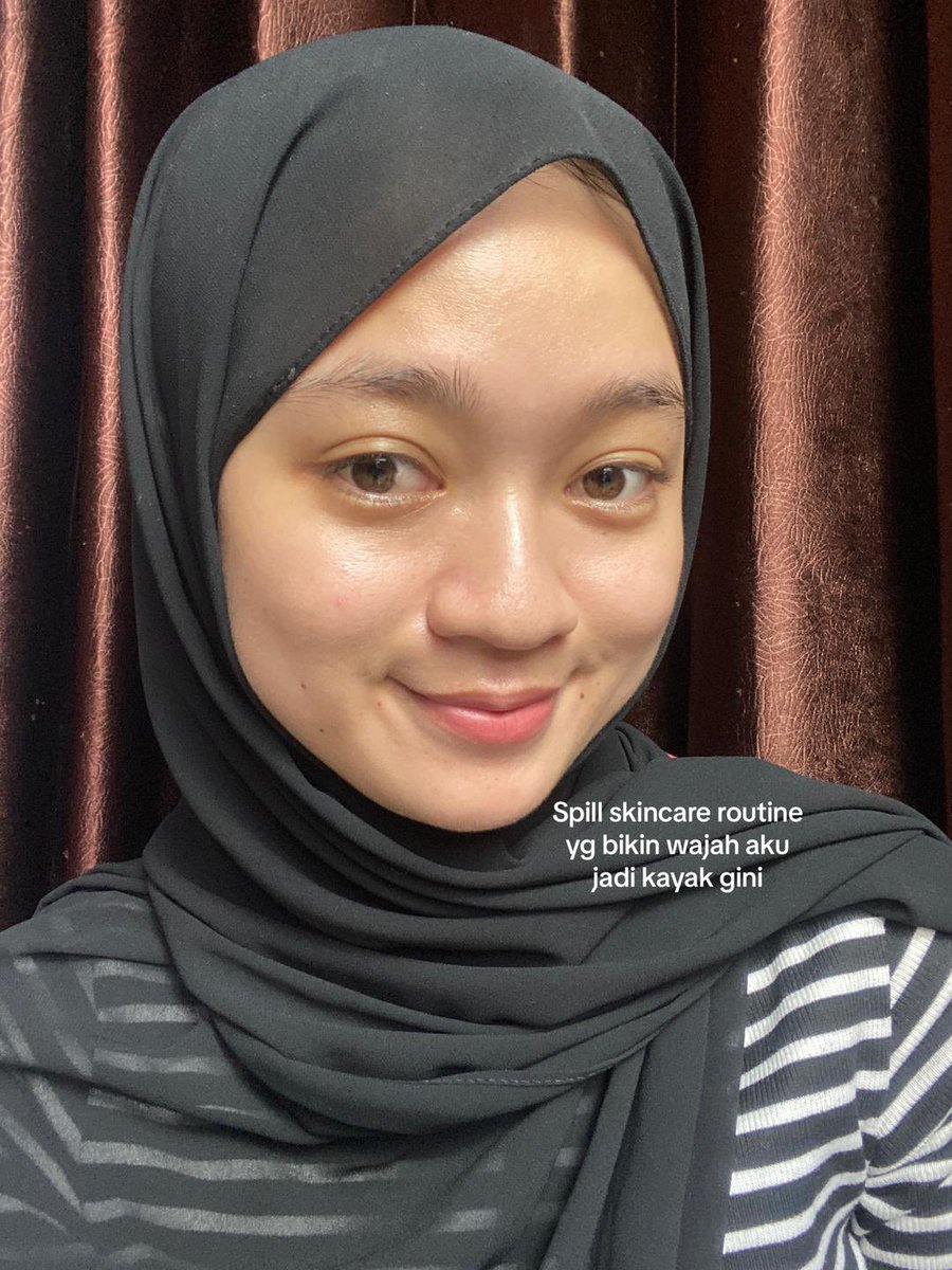 icacaica_'s tweet photo. Part 1 Review jujur
Spill skincare yg bikin kulit aku jadi glowing🤍

https://t.co/rcC6OW9BVJ
https://t.co/b2YhTYSAZo
https://t.co/yShFocVBuB https://t.co/fV6NxjIojL