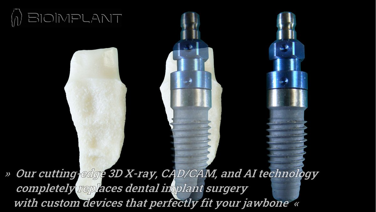 BioImplant (@bioimplant) on Twitter photo 