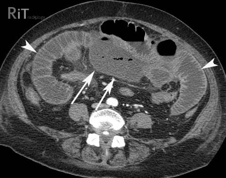 Our Case of the Month highlights how error can often be multifactorial
 
Here an elderly patient did not get an urgent CT scan as surgical team were awaiting blood results

Tragically, as a result of delays, the patient died

Read our findings &amp; report
👇
coress.org.uk/case-of-the-mo…