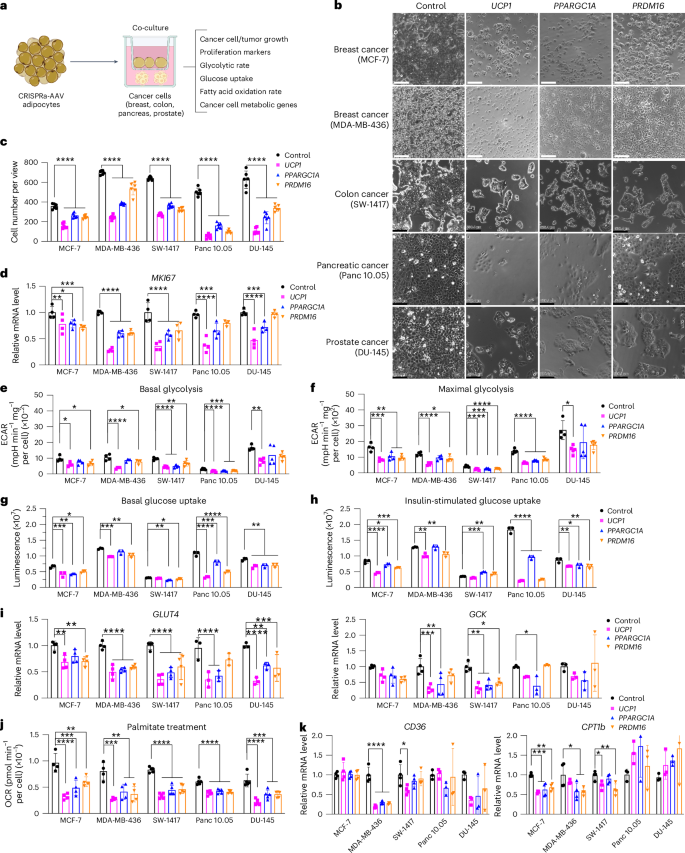Implantation of engineered adipocytes suppresses tumor progression in cancer models go.nature.com/4gqhxvw