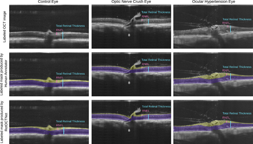 ARVOtvst's tweet photo. Andrew Feola et al. @EmoryEyeCenter @CoulterBME
present RetOCTNet: Deep Learning–Based Segmentation of OCT Images Following Retinal Ganglion Cell Injury, https://t.co/ii8rOcMDkx. https://t.co/QphXXmEYvS