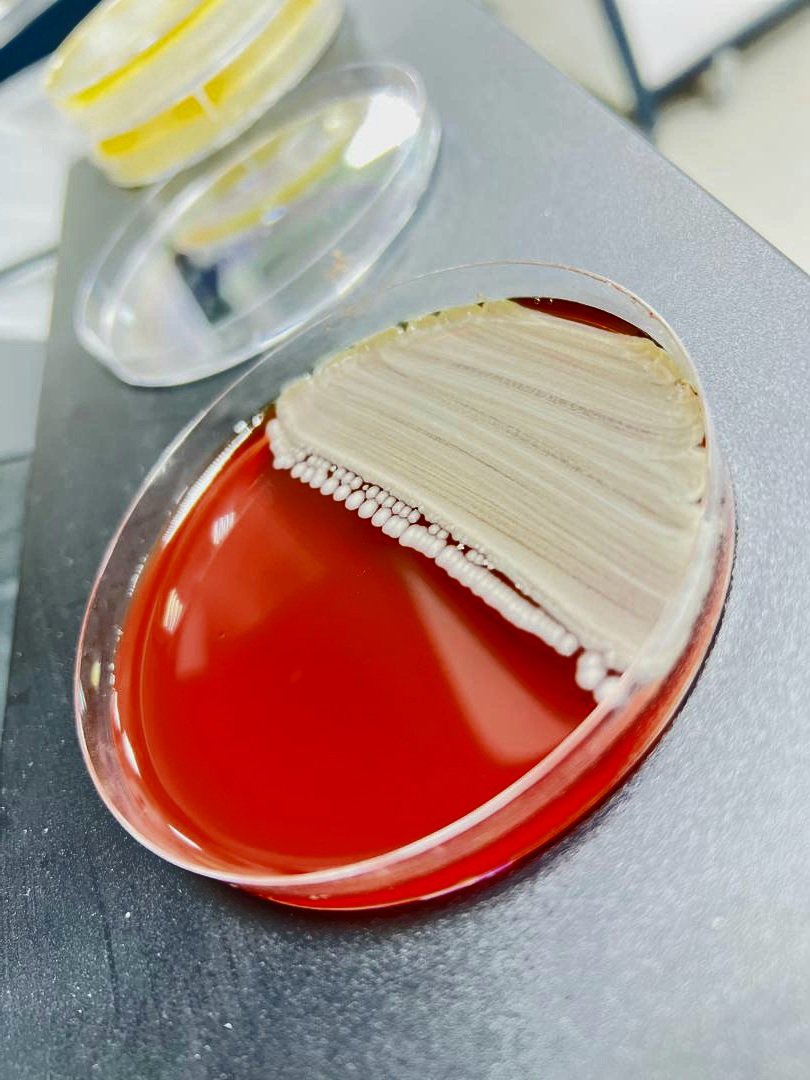 BLOOD agar  in CQ
