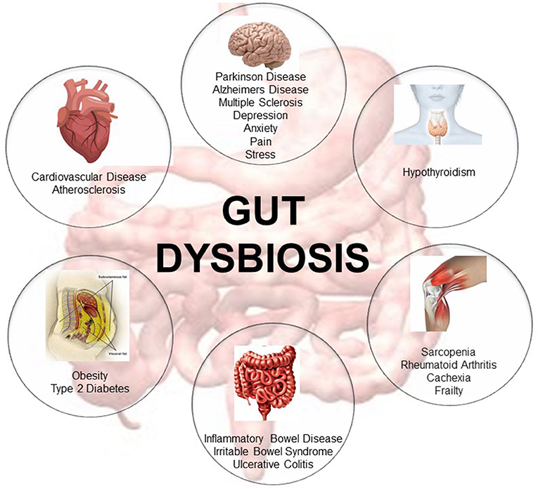 ViditaVaidya's tweet photo. “modern civilization’s highly processed foods, broad-spectrum antibiotics, and enhanced hygiene, we may be tipping the balance away from this long-term association—and actually placing that relationship in danger.” https://t.co/Xji7E7eppi