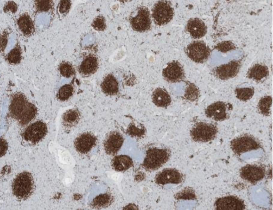 A Science #Immunology study from last year describes an antibody-based alternative treatment for B cell non-Hodgkin #lymphoma that boosts #NaturalKillerCell antitumor activity in preclinical models without causing serious toxicities. bit.ly/4fM7bpT #WorldCancerDay
