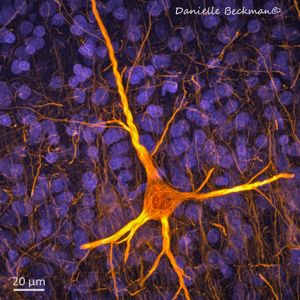 DaniBeckman's tweet image. In hard times like now, I hope scientists and society can continue together. This is a human neuron from a 94-YO man with a perfect score on memory test, died of nonneuro causes. Thanks to his donation we can continue to learn that age-related cognitive decline is not inevitable.