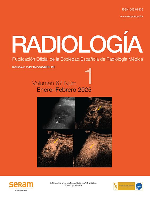 @RevistaRADIOLOGIA (@revistaradiolo2) on Twitter photo ¡Ya está aquí el primer número del año! Abre con una editorial de <a href="/sagompe/">Sara Gomez</a> sobre el papel de la mujer en el mundo editorial. Y comienza la serie sobre IMAGEN CARDÍACA con el artículo TC perfusión y FFR-TC en la enfermedad coronaria de <a href="/AnaEzponda/">Ana Ezponda</a>
elsevier.es/es-revista-rad… ¡Ya está aquí el primer número del año! Abre con una editorial de <a href="/sagompe/">Sara Gomez</a> sobre el papel de la mujer en el mundo editorial. Y comienza la serie sobre IMAGEN CARDÍACA con el artículo TC perfusión y FFR-TC en la enfermedad coronaria de <a href="/AnaEzponda/">Ana Ezponda</a>
elsevier.es/es-revista-rad…