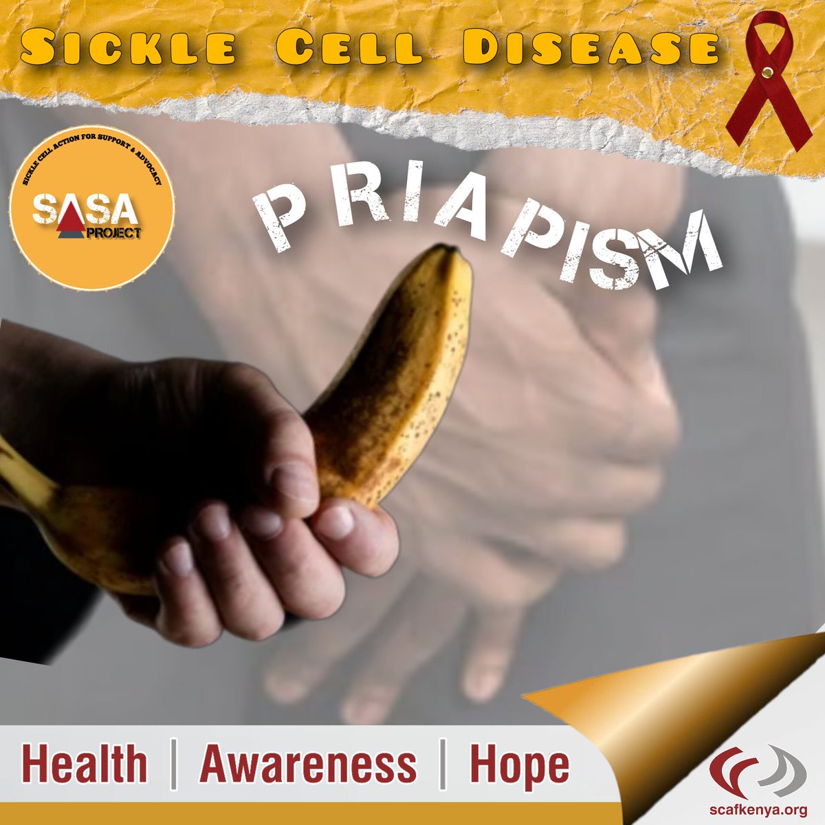 SCAFKenya's tweet image. Did you know Female #SickleCell Warriors can experience 𝐜𝐥𝐢𝐭𝐨𝐫𝐚𝐥 #PRIAPISM? 
Read more here:  m.facebook.com/story.php?stor… #SickleCellDisease #SickleCellWarrior #SCD #SASAproject #SCAFKENYA #SickleCellAwareness #SickleCellAnemia #SickleCellComplication #Erection #SCDCrisis