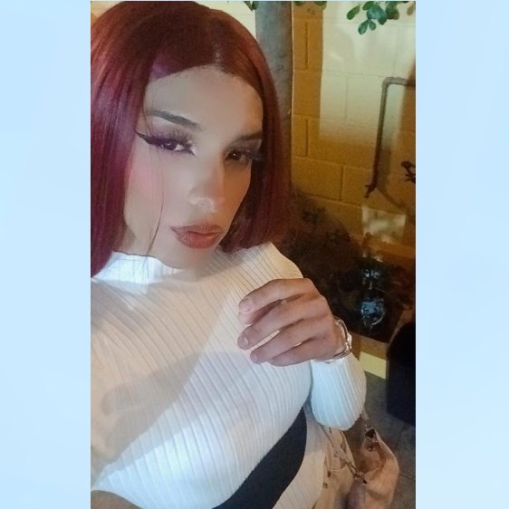MorochaHernand3's tweet photo. #ardienteycaliente 💋 https://t.co/dLZcJEDOiY