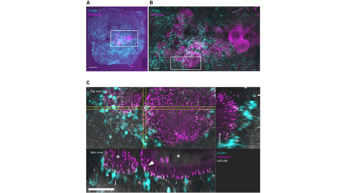 stemcellreports's tweet photo. New #organoid research: Transplantation of genome-edited retinal organoids restores some fundamental physiological functions coordinated with severely degenerated host retinas

@riken_en @ISSCR @CellPressNews @GairdnerAwards @SickKidsNews 

https://t.co/yKcHjiYh6x https://t.co/1KkPHKU0yQ