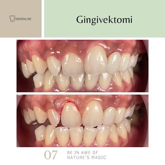 jessie — koass dokter gigi🦷 tweet media