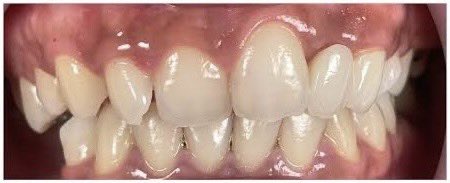 jessie — koass dokter gigi🦷 tweet media