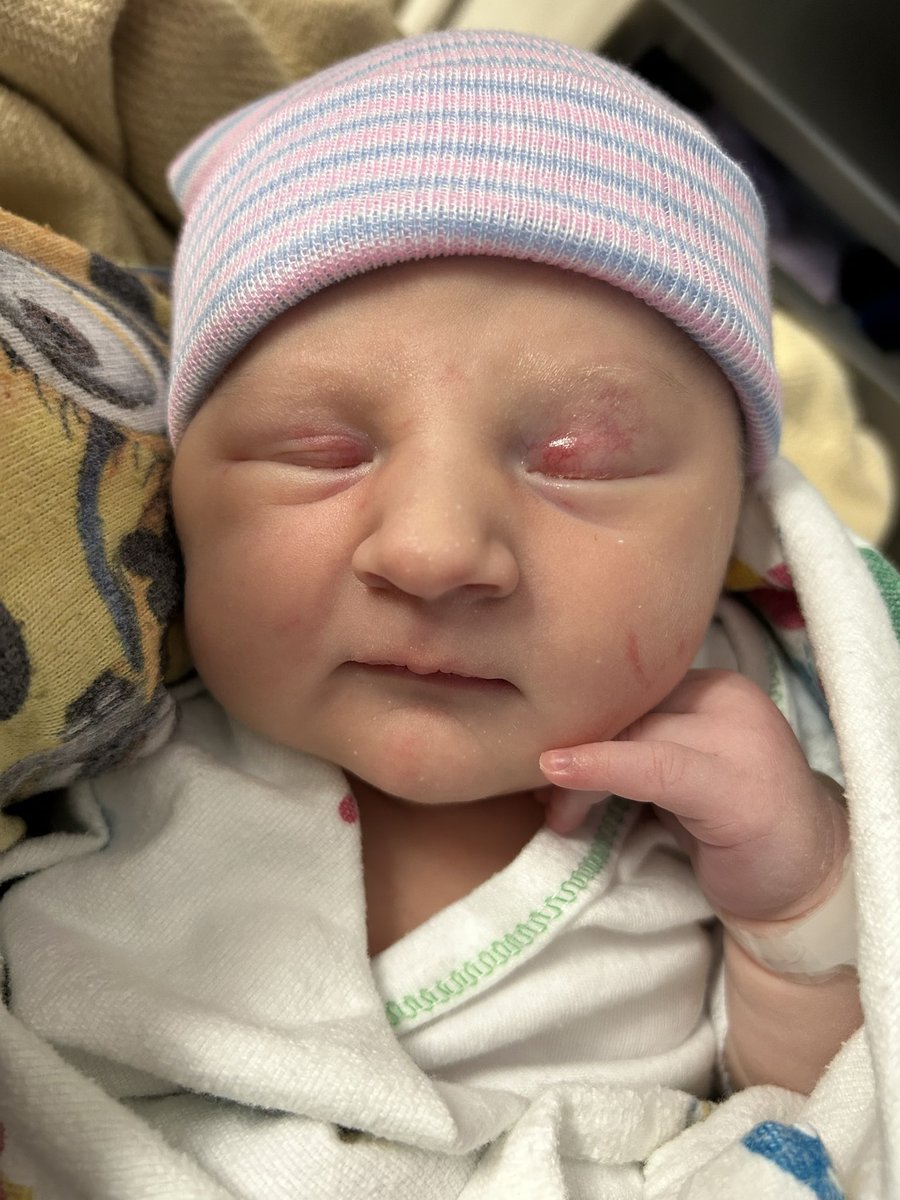 Kat42345's tweet photo. We welcomed the 6th little nerd to the family yesterday. Baby Mary aka chipmunk. https://t.co/76tZEuRIfI