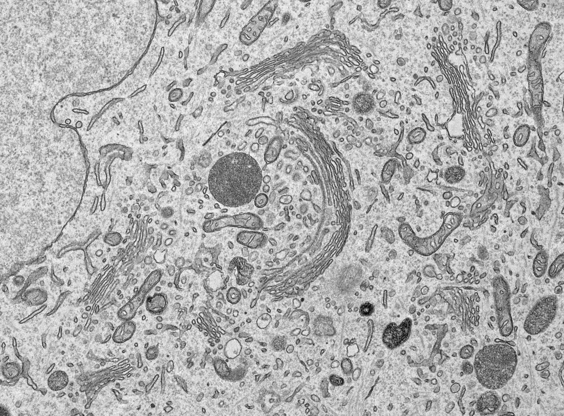 TEM of a cell cytoplasm displaying several Golgi apparatus, vesicles, nucleus, mitochondria, lisosomes.