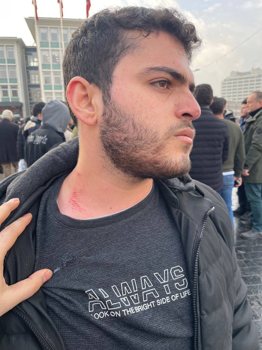 ismet05072023's tweet photo. Miraç ve Namaz" konulu konferansın duyuru çalışmalarını engelleyen #AnkaraEmniyeti, branda nöbeti tutanlara sert müdahalede bulunuyor!

DiniKonferansa Engel https://t.co/771CrHXTKg